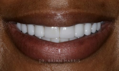 31 after dr brian harris
