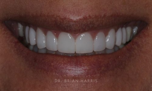 28 after dr brian harris