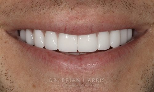32 after dr brian harris
