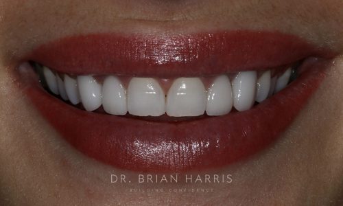 32 after dr brian harris